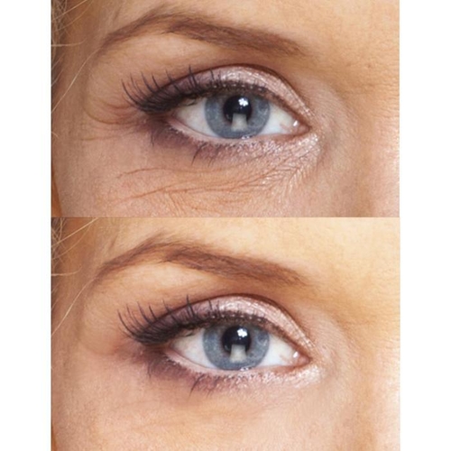 Youth Treatment: Eye Wrinkle Treatment + Night Repair Cream - Image 5