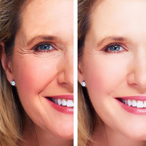 Youth Treatment: Eye Wrinkle Treatment + Night Repair Cream - Image 4