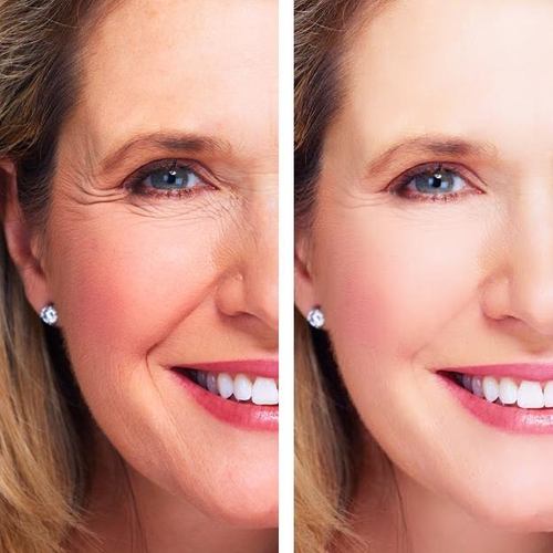 Ageless Beauty: Eye Repair Cream + Antioxidant Serum + Repair Night - Image 4