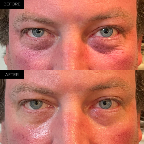 Endure™ Beauty Organic Awakening Under Eye Therapy Gel Pads - Image 4