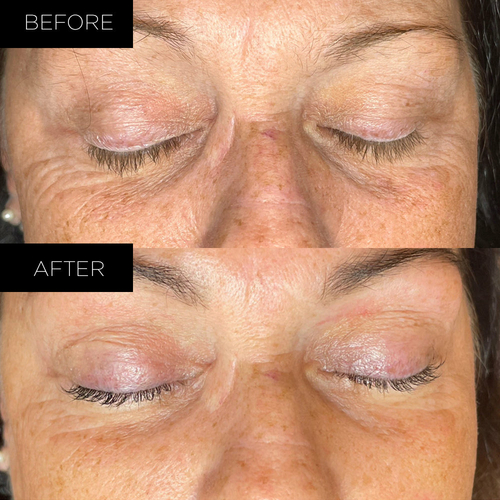 Endure™ Beauty Organic Awakening Under Eye Therapy Gel Pads - Image 5