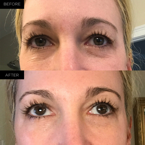 Endure™ Beauty Organic Awakening Under Eye Therapy Gel Pads - Image 3