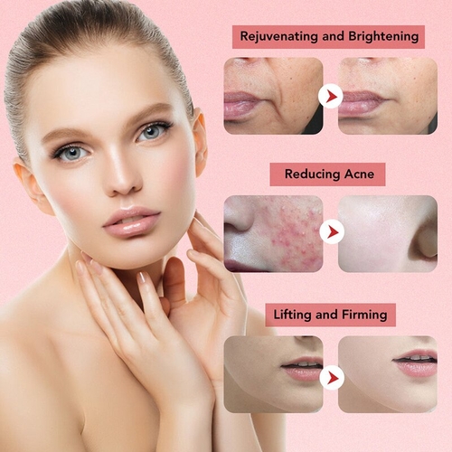 7 In 1 RF Face Massager Skin Rejuvenation Mesotherapy Facial Lifting - Image 3