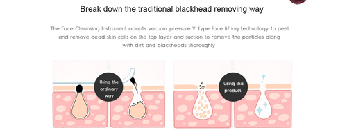 Electric Acne Blackhead Remover Skin Vacuum - Image 5