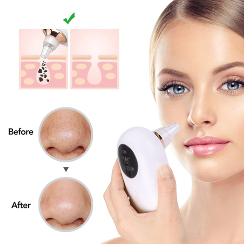 Portable Face Deep Pore Cleaner Vacuum Blackhead Remover - Image 2